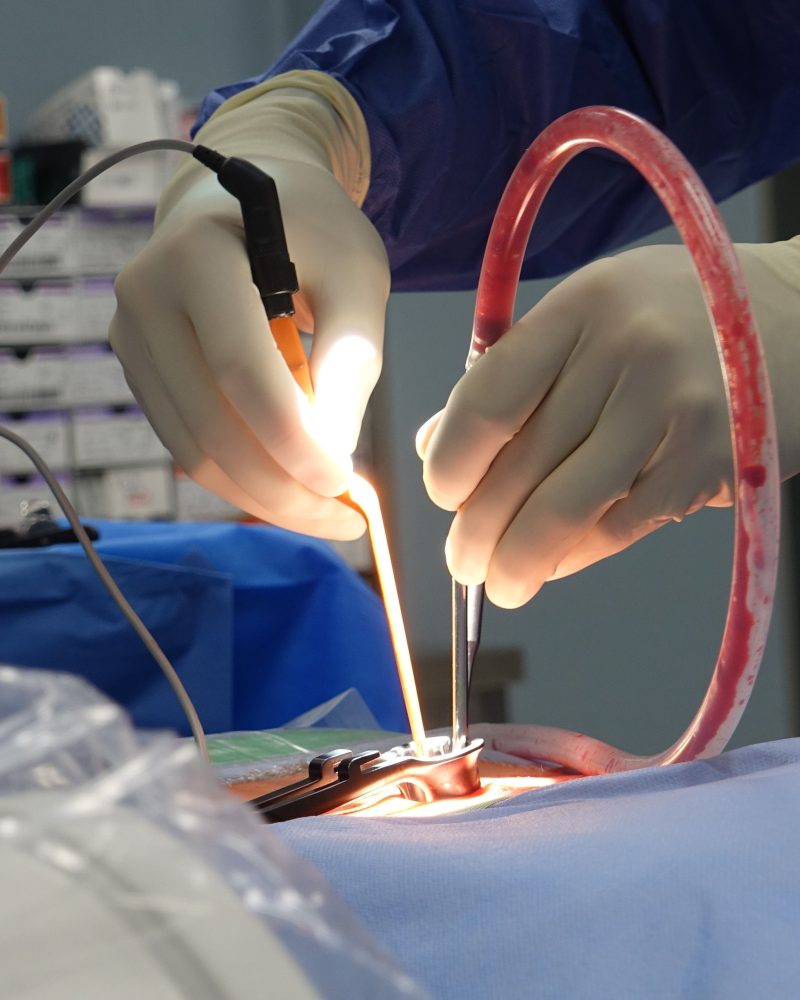 Equipe medicale realisant une intervention chirurgicale