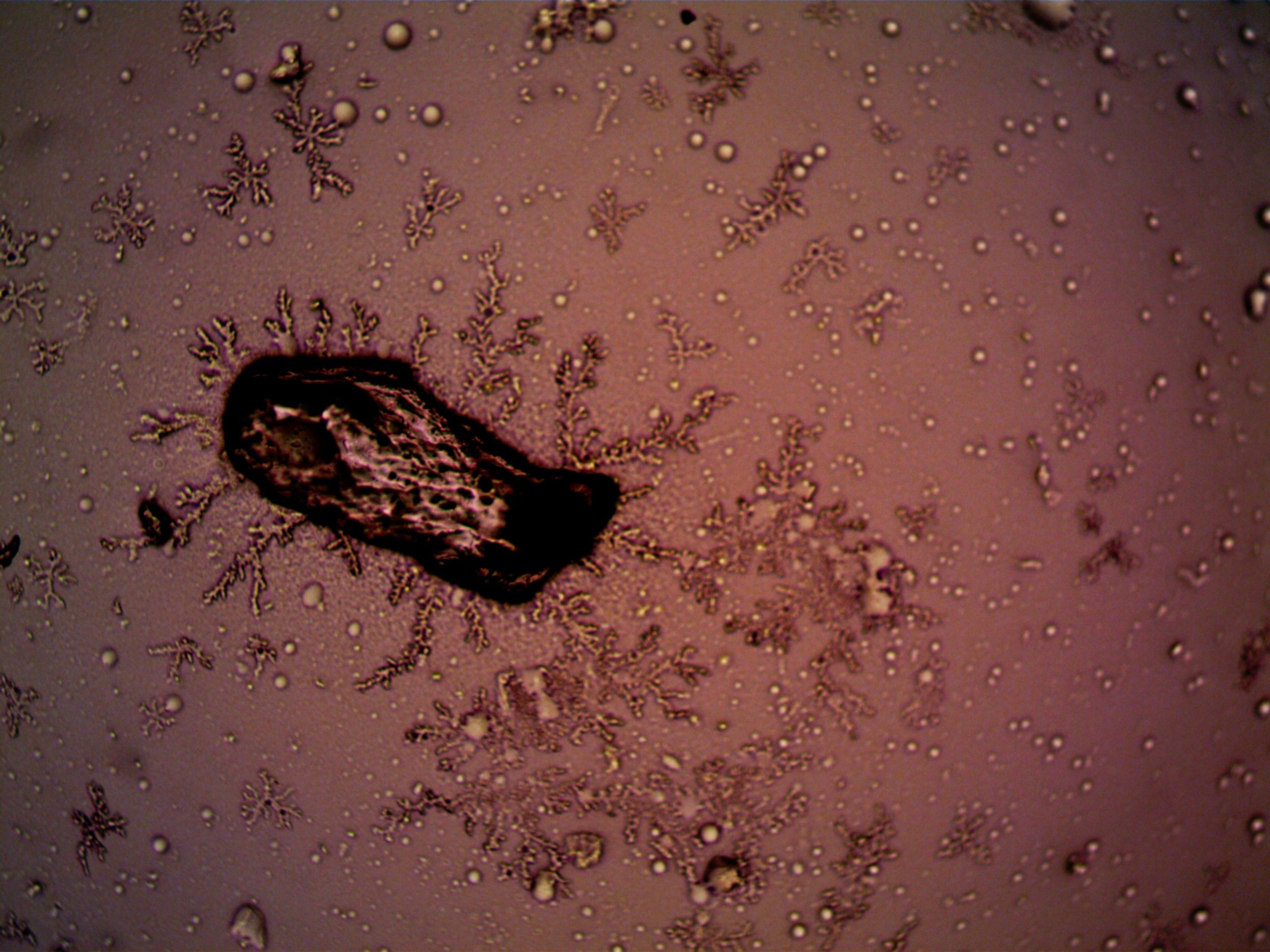 Bactéries et cristaux observés au microscope