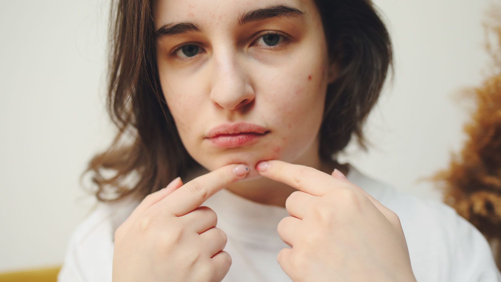 Femme touchant son visage marqué par des lésions