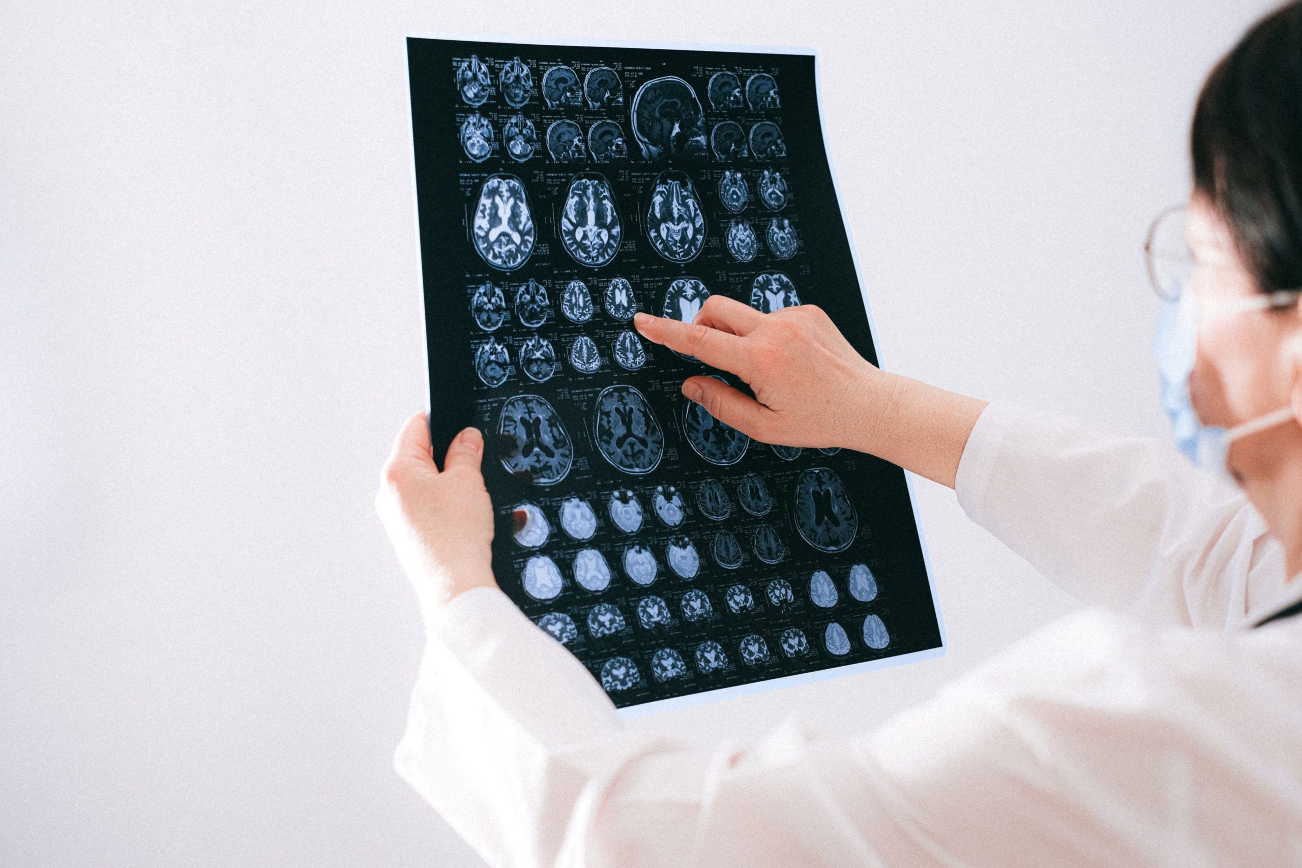 Médecin examinant de près des IRM cérébrales
